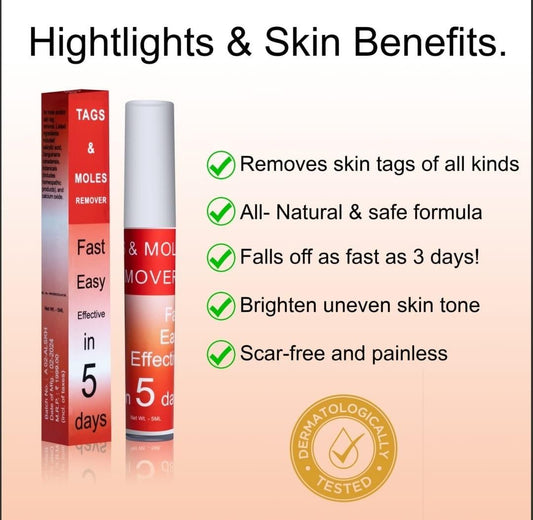 LOVILDS™ Tags & Moles Remover (Buy 1 Get 1 Free🔥🔥)